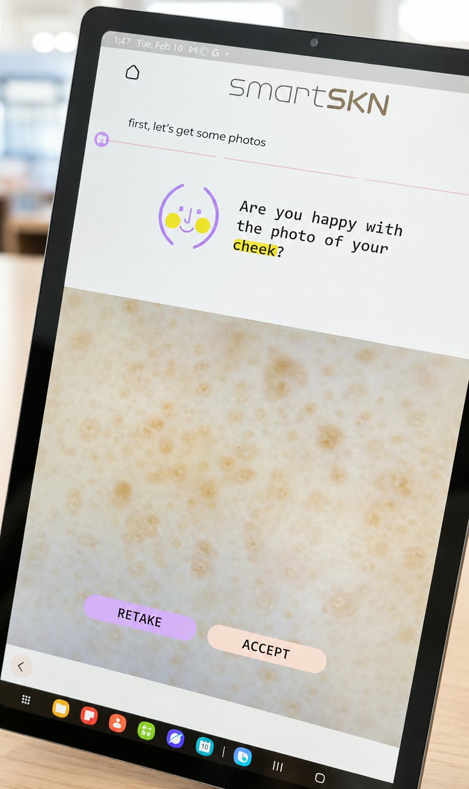 A smartSKN capture screen on a tablet showing a 60× magnified photo of a client's cheek with retake and accept options